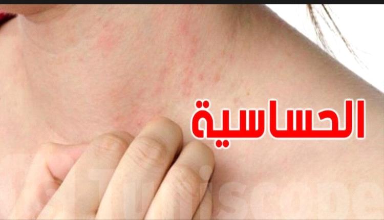 ثورة طبية: لقاح  جديد قد يقضي على الحساسية المهددة للحياة