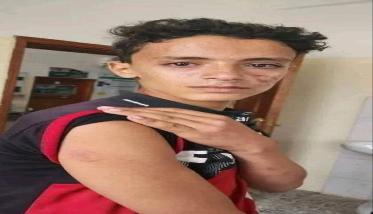 مشرف حوثي يعتدي على طفل ووالدته في ريمة ويسبب إسقاط جنينها
