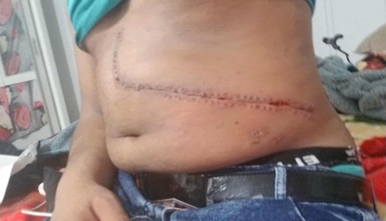 باع نصف كبده طيبةً فخانوه قسوةً… مأساة شاب فقير خُدع باسم الإنسانية!