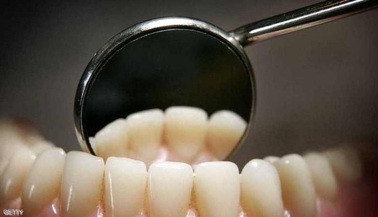 دراسة: فقدان الأسنان يرفع خطر الوفاة