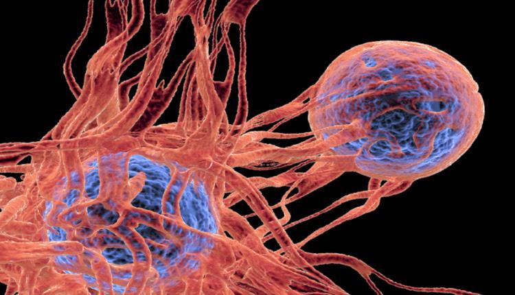 نقلة نوعية في علاج السرطان !
