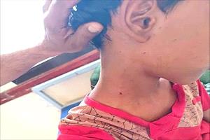 قناص حوثي يصيب طفلًا أثناء رعيه للأغنام في لحج