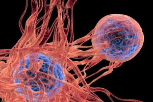 نقلة نوعية في علاج السرطان !
