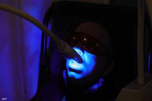 تبييض الأسنان.. تحذير من منتجات "خطيرة" تباع عبر الإنترنت