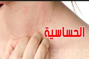 ثورة طبية: لقاح  جديد قد يقضي على الحساسية المهددة للحياة