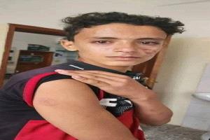 مشرف حوثي يعتدي على طفل ووالدته في ريمة ويسبب إسقاط جنينها