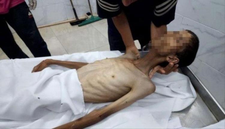 367 وفاة فلسطينية بغزة نتيجة التجويع الإسرائيلي

