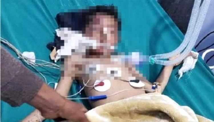 رحلة بحث عن الرزق تنتهي بكارثة سير في طريق إب  الضالع

