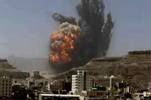 وزير يمني يصف صنعاء بأنها "العين في الرأس" ويدعو المجتمع الدولي للتدخل
