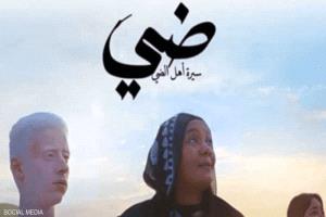 مصر.. فيلم ضي يتناول مرض "الألبينو" بمشاركة محمد منير