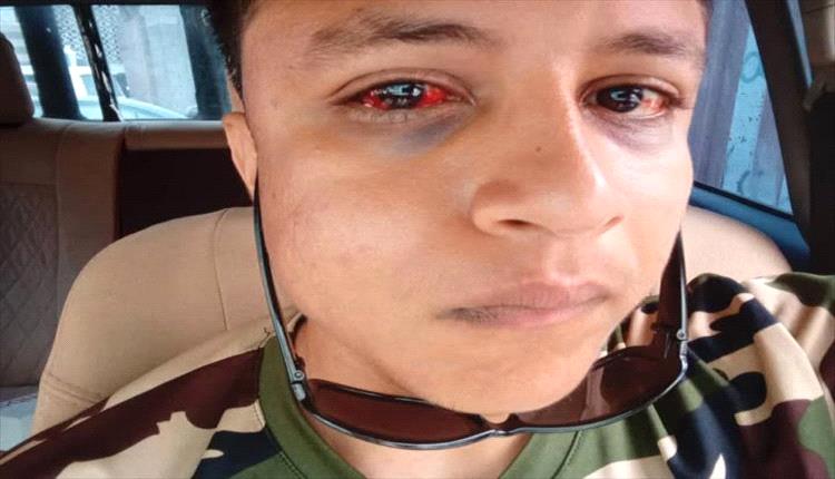 اعتداء مروع على مواطن في شرطة عدن.. محامية تطالب بتحقيق عاجل