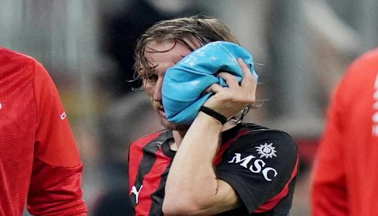 مودريتش سيخضع لجراحة بعد تعرضه لكسر في الوجنة
