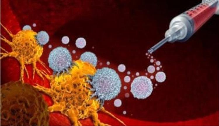 اكتشاف علمي جديد قد يمهّد لعلاج مبتكر لسرطان الغدد الليمفاوية