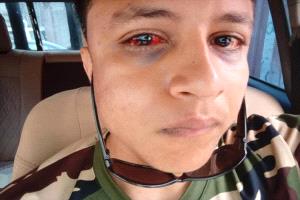 اعتداء مروع على مواطن في شرطة عدن.. محامية تطالب بتحقيق عاجل