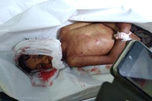 جريمة أسرية تتحول إلى مأساة مزدوجة في الضالع وسقوط طفل قتيل