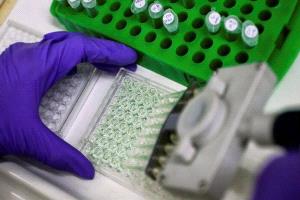 تطور في تعديل الجينات قد يؤدي إلى علاج لـ«متلازمة داون»