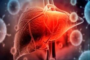 دهون الكبد تحت السيطرة: خطوات بسيطة تصنع الفرق