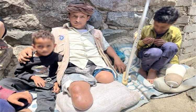 الصليب الأحمر: 4.5 مليون يمني بحاجة إلى خدمات ومساندة بسبب الإعاقة