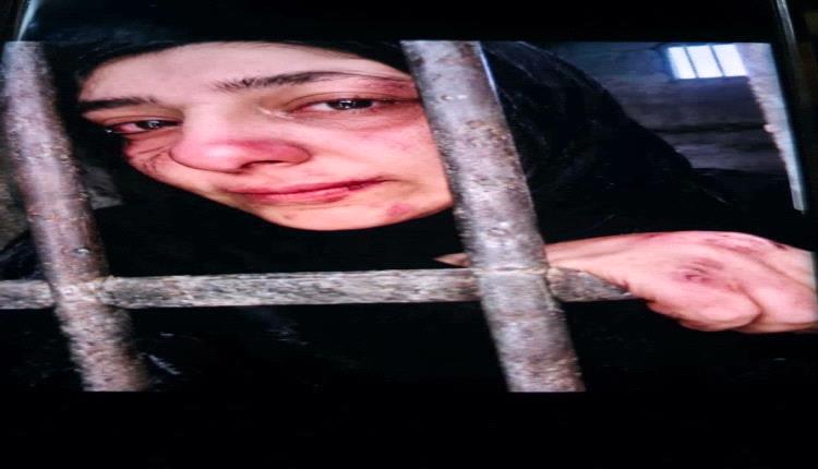 ناشطة يمنية: اعتقالات النساء في مناطق مليشيات  الحوثيين تتسع وسط انتقادات حقوقية