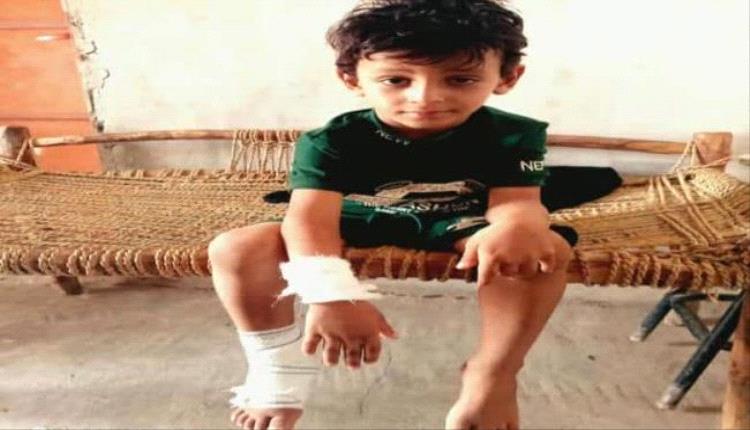 إصابة طفل جراء هجوم حوثي بطائرة مسيّرة جنوب الحديدة