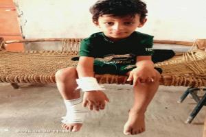 إصابة طفل في استهداف حوثي بمسيّرة حيًا سكنيًا في حيس بالحديدة