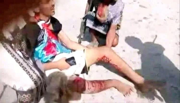 هجوم عنيف على متظاهري حضرموت وإصابات بالرصاص الحي