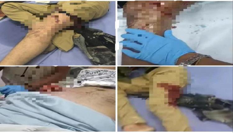 الجنوب بين السياسة والحقوق.. تصاعد الجدل حول حملات قمع النشطاء المؤيدين للانتقالي