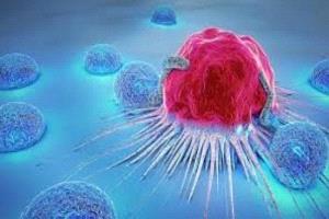 جائحة كوفيد-19 تسرّع وفاة مرضى السرطان في الولايات المتحدة