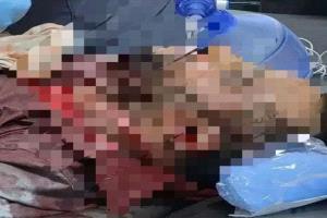 رصاص الاحتلال في عتق يوقظ روح التحرر الجنوبي