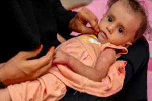 اليمن على حافة الانهيار الصحي