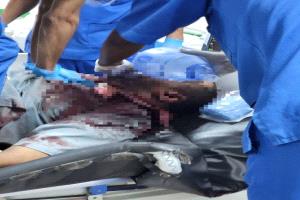 رصاص الأمن في عتق: 3 شهداء وأكثر من 18 جريحًا