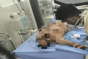 مجزرة معاشيق: شهيد و20 جريحاً برصاص قمع المتظاهرين