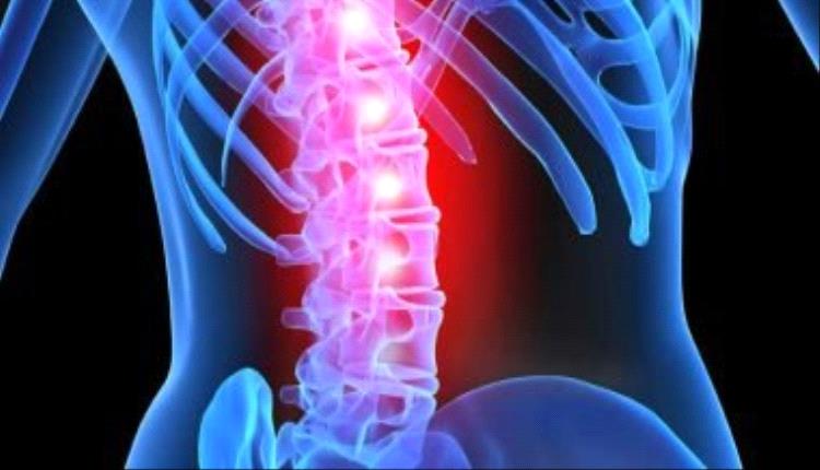 لماذا يهاجم الورم النخاعي الرجال بشراسة أكبر؟