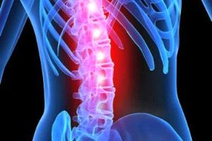 لماذا يهاجم الورم النخاعي الرجال بشراسة أكبر؟