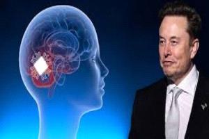 شرائح تُخاطب العقل… ماسك يعلن 2026 عامًا فاصلاً لثورة الدماغ الرقمي
