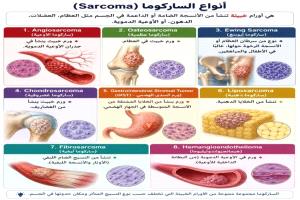 الساركوما تحت الضوء.. دعوة للتشخيص المبكر في شهر التوعية بسرطان العظام