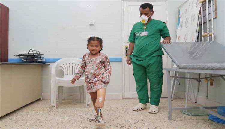 مركز الأطراف الصناعية بسيئون ينجز أكثر من 9 آلاف خدمة مجانية لآلاف المستفيدين خلال 5 أشهر
