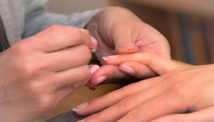 7 تغيرات في الأظفار تكشف عن مشكلات صحية
