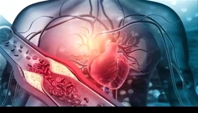 أطباء يحذرون: أعراض صامتة قد تكشف أمراض صمامات القلب مع التقدم في العمر