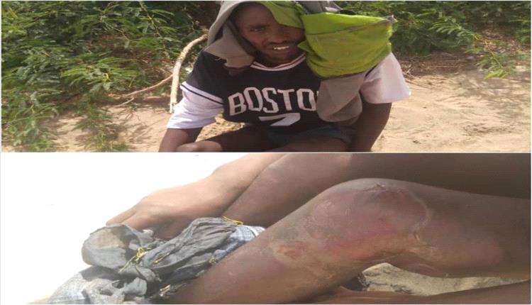 أحور.. انتهاكات وابتزاز يهددان حياة المهاجرين الأفارقة