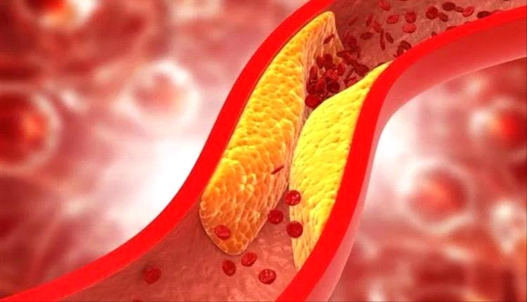 أطعمة تساعد على خفض الكوليسترول وتعزيز صحة القلب