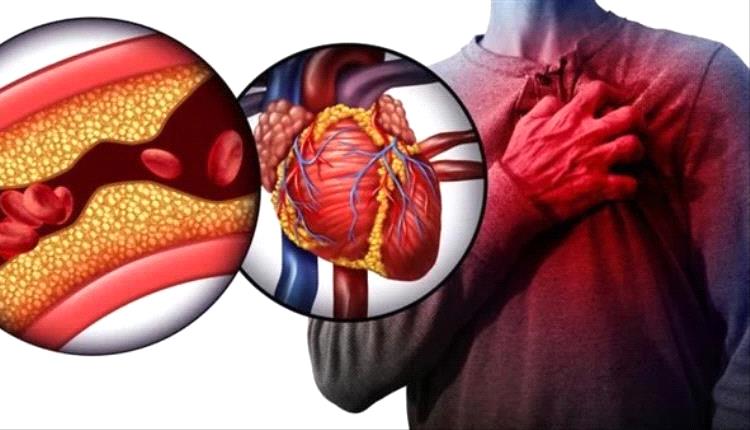 أطباء يوضحون أسباب ارتفاع الكوليسترول الضار وسبل الوقاية منه