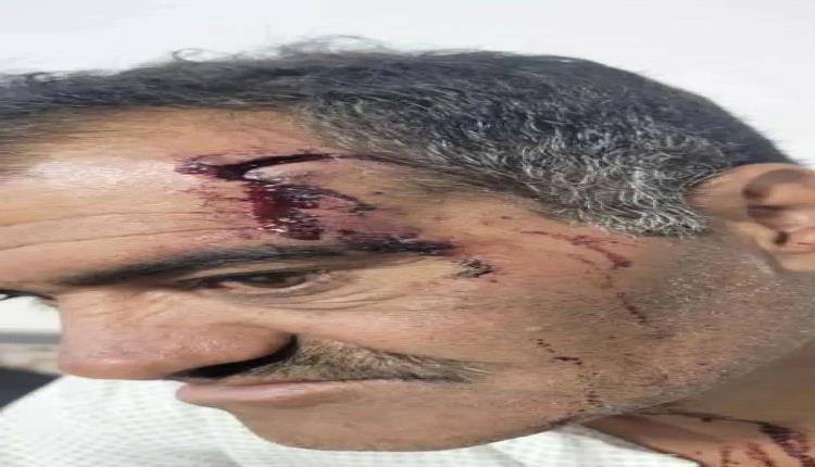 ذمار.. اعتداء وحشي واختطاف يطول عاقل حارة "المجد" من قبل عناصر هيئة الزكاة الحوثية
