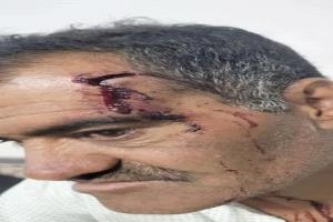 ذمار.. اعتداء وحشي واختطاف يطول عاقل حارة "المجد" من قبل عناصر هيئة الزكاة الحوثية
