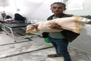 توقيف طاقم طبي في تعز للتحقيق عقب وفاة طفلة داخل مستشفى حكومي