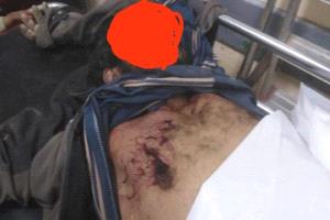 مقتل عامل برصاص قيادي حوثي في صعدة على خلفية خلاف مالي