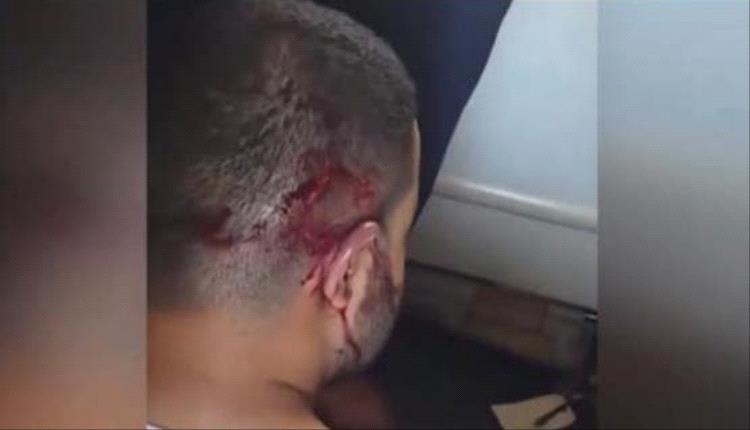 صور جديدة لمساعد طيار فلاي دبي بعد السيطرة عليه خلال الرحلة