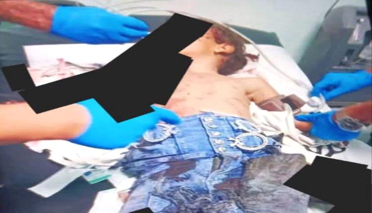 إصابة طفلة بجروح بالغة إثر انفجار بقايا مقذوف في الضالع