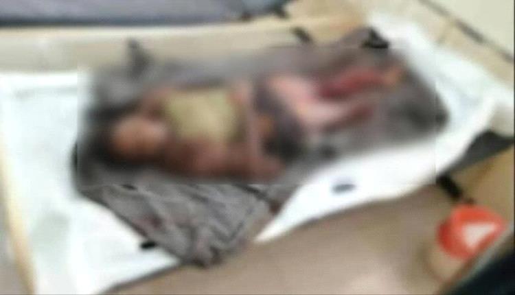 مقتل طفل في انفجار لغم أرضي زرعته مليشيا الحوثي جنوب الحديدة