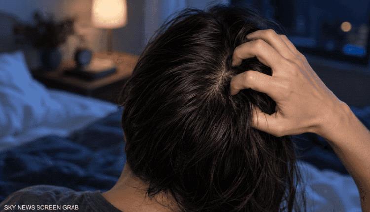لماذا تشتد حكة فروة الرأس عند النوم